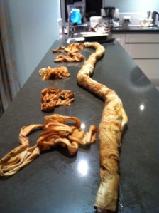 After removal of the bandages